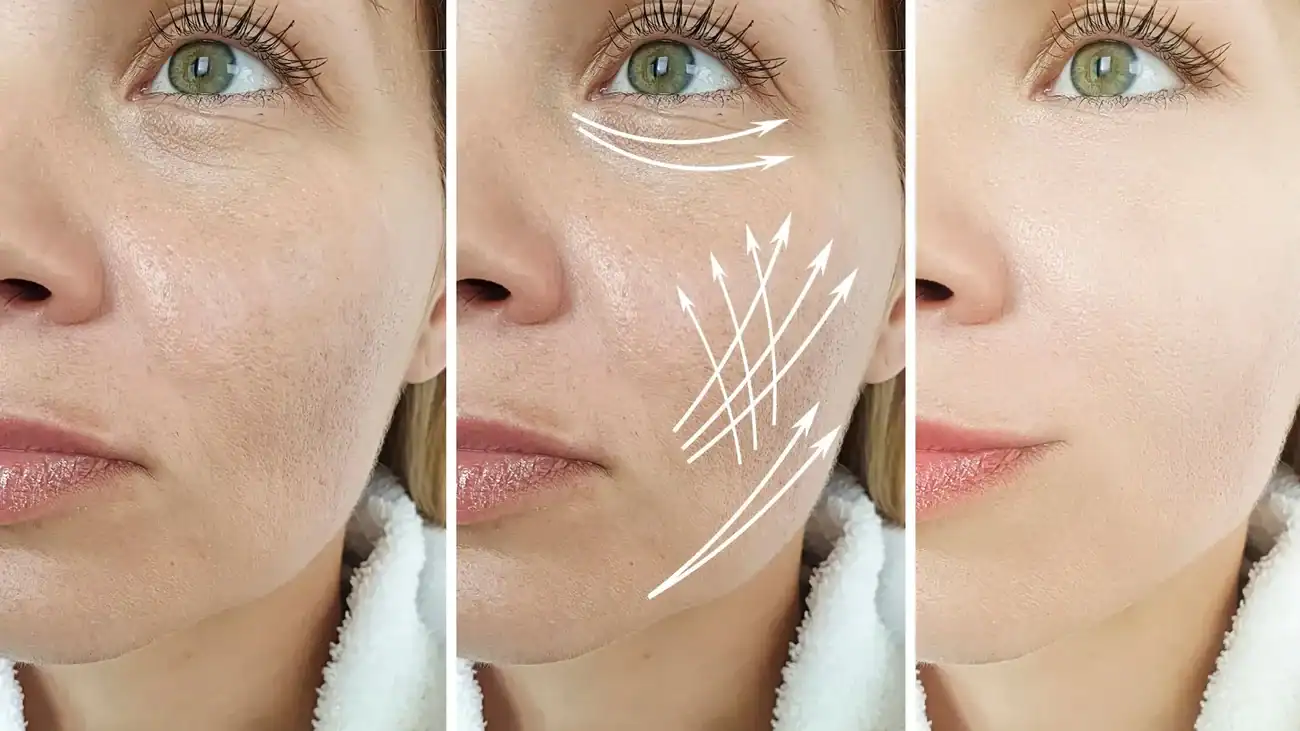 Can One Treatment Really Tackle More Than One Skin Concern Middlesex?