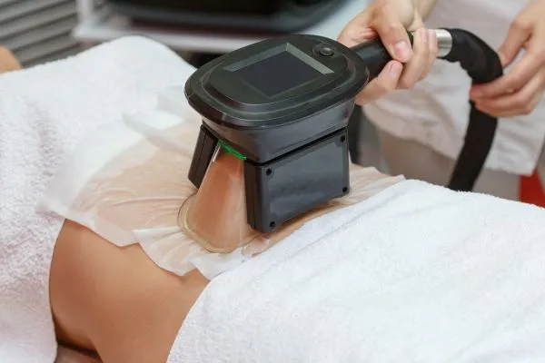 Image of person having fat freezing treatment to help weight gain Middlesex