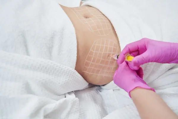 image of fat dissolving injections on love handles to help combat weight gain Middlesex