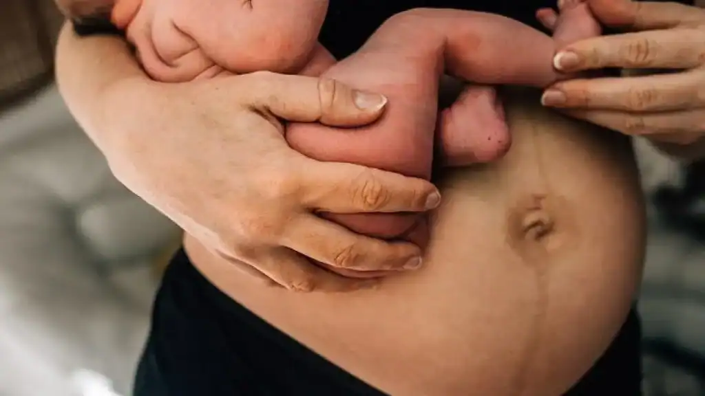 Why Is My Stomach Still Big After Pregnancy Middlesex?